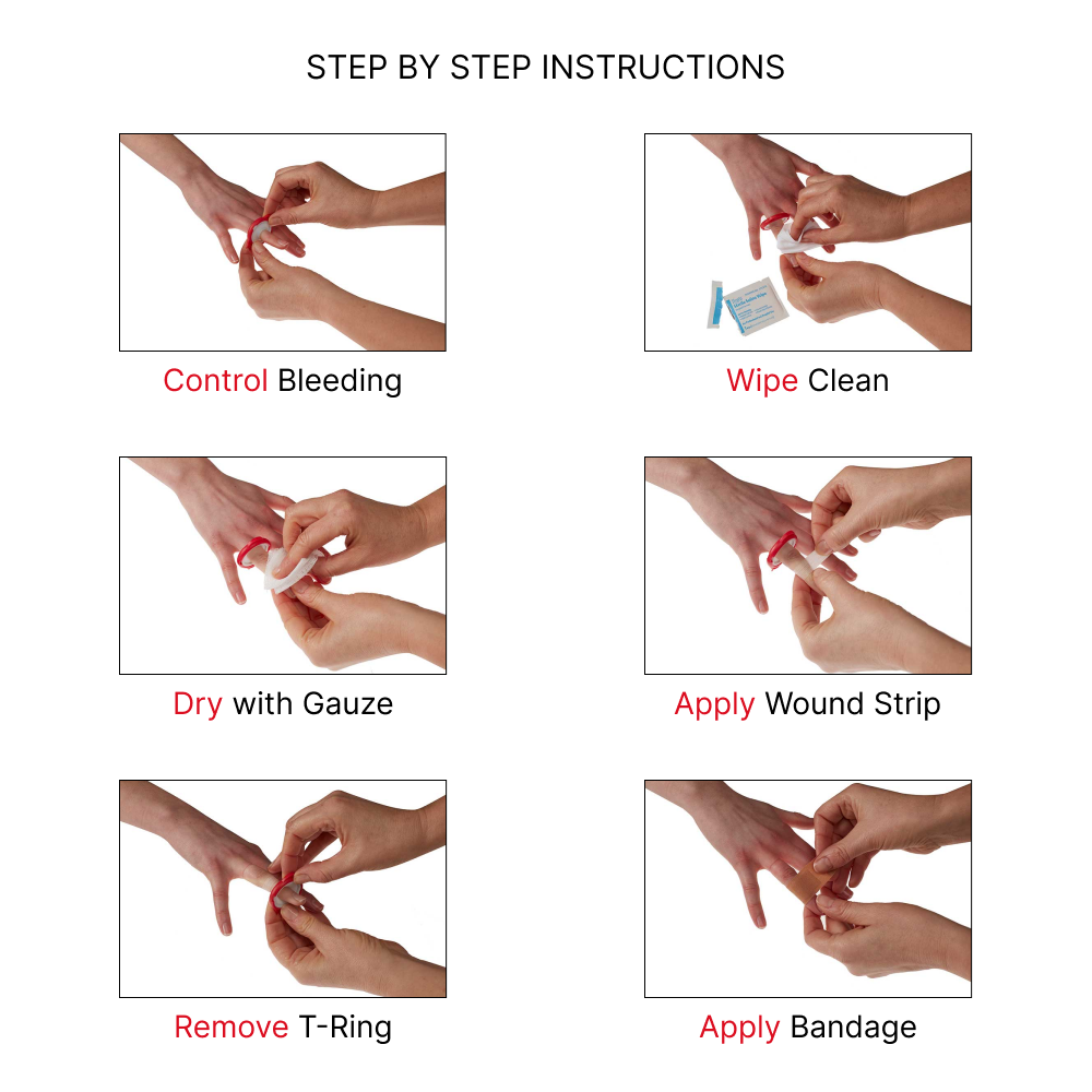 T-Ring - Finger Cut Kit (Medical Finger Ring Kit / Finger Tourniquet for Fingers and Toes) - deltatacstore